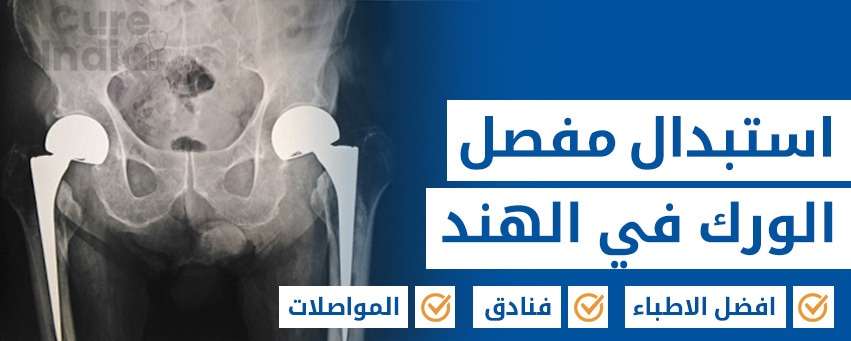 زراعة مفصل الورك